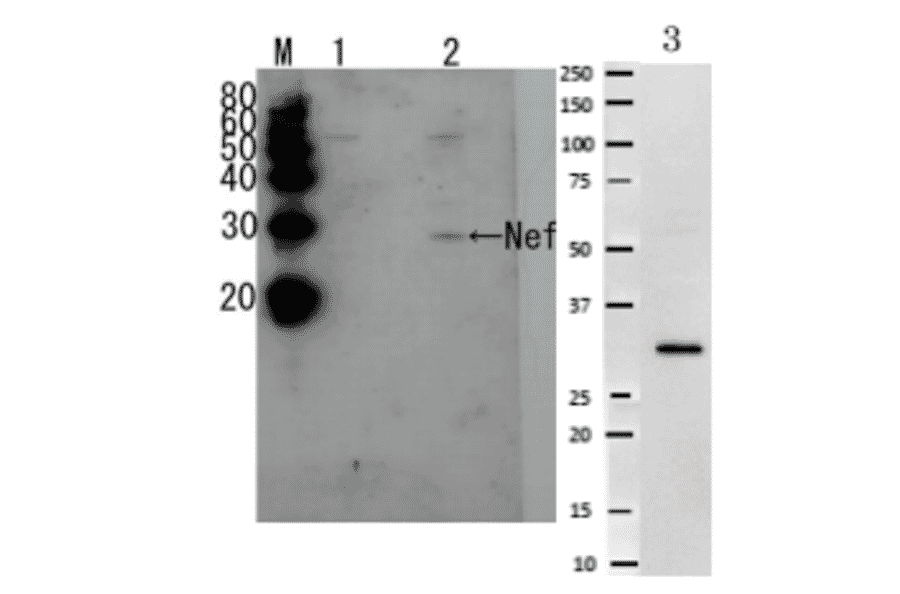 Detection of HIV-1 and HUV-2 Nef by Western blotting
