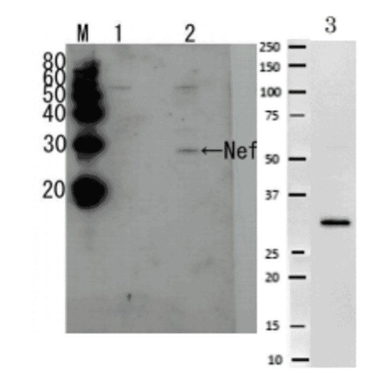 Detection of HIV-1 and HUV-2 Nef by Western blotting