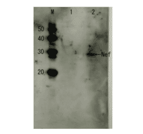 Detection of HIV-1 Nef by Western blotting