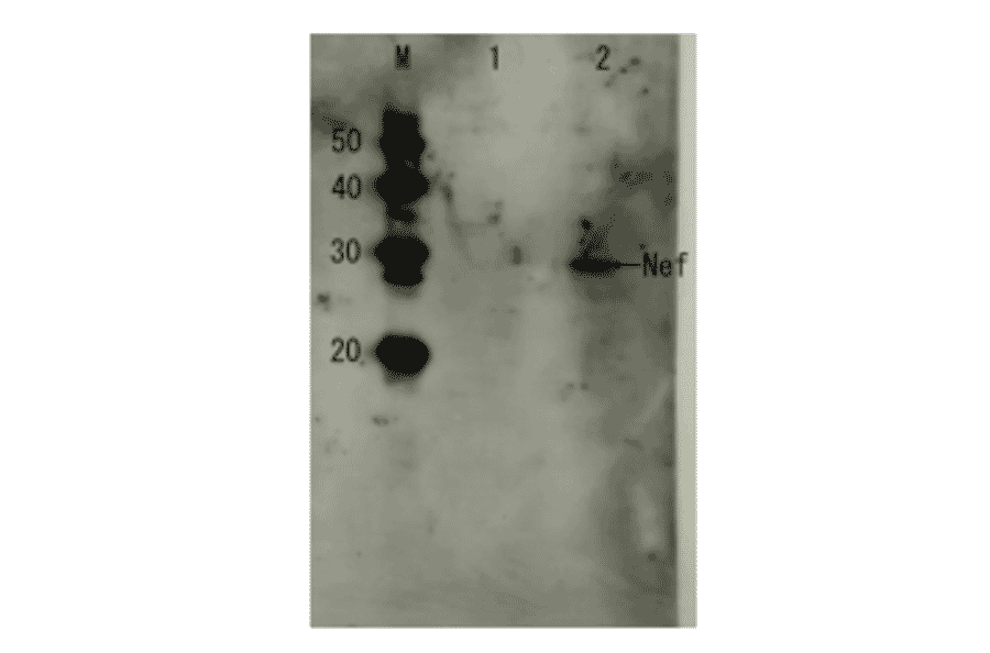 Detection of HIV-1 Nef by Western blotting