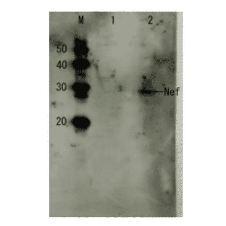 Detection of HIV-1 Nef by Western blotting