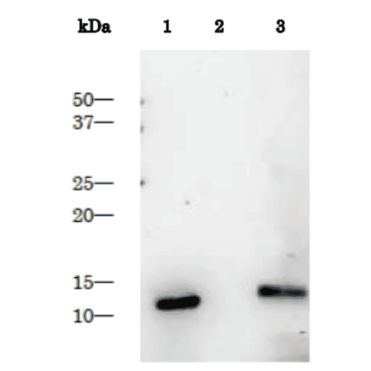Detection of HIV-1 proteinase in the extract of HIV-1 infected cells by Western blotting using anti-HIV-1 protease antibody.