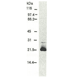 Western blotting of HCV core protein. Chimp liver cells were infected with recombinant vaccinia virus containing a HCV genome cDNA and were subjected to Western blotting using this antibody. The core protein is detected as a 22-kDa band.