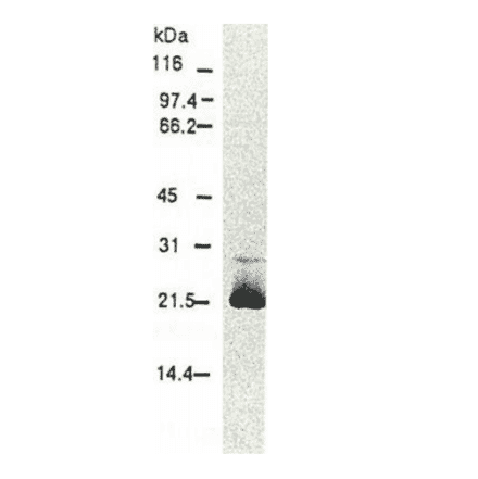 Western blotting of HCV core protein. Chimp liver cells were infected with recombinant vaccinia virus containing a HCV genome cDNA and were subjected to Western blotting using this antibody. The core protein is detected as a 22-kDa band.