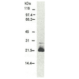 Western blotting of HCV core protein. Chimp liver cells were infected with recombinant vaccinia virus containing a HCV genome cDNA and were subjected to Western blotting using this antibody. The core protein is detected as a 22-kDa band.