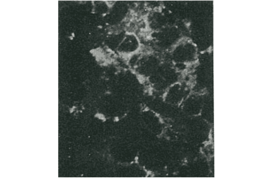 Detection of HCV core protein by immunofluorescence antibody staining. Chimp liver cells were infected with recombinant vaccinia virus containing a HCV genome cDNA. After incubation for 48 hr, the cells were fixed with acetone and HCV core protein was detected by indirect immunofluorescence staining using this antibody.