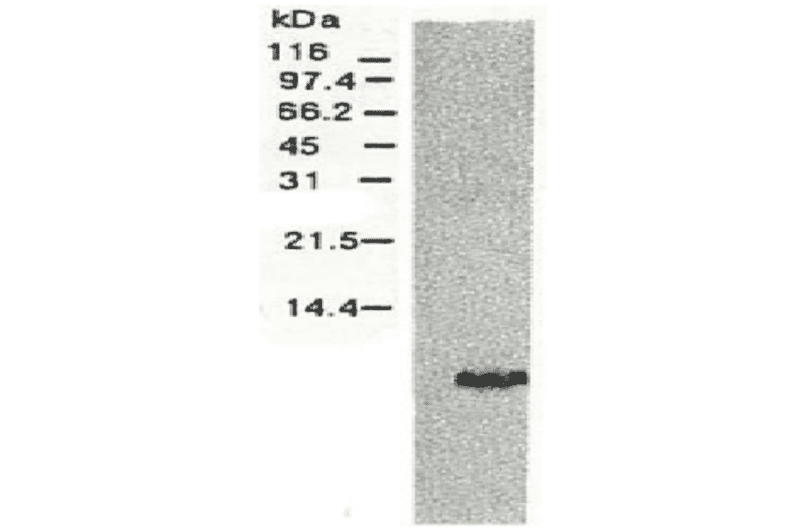 Western blotting of HCV NS4A protein.Chimp liver cells were infected with recombinant vaccinia virus containing a HCV genome cDNA and were subjected to Western blotting using anti-NS4a antibody. The protein detected with this antibody is 6 kD. This small NS4 protein (NS4a) was produced from the N-terminal region of the NS4 protein. 