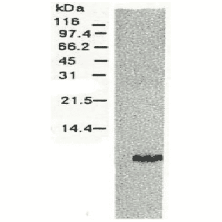 Western blotting of HCV NS4A protein.Chimp liver cells were infected with recombinant vaccinia virus containing a HCV genome cDNA and were subjected to Western blotting using anti-NS4a antibody. The protein detected with this antibody is 6 kD. This small NS4 protein (NS4a) was produced from the N-terminal region of the NS4 protein. 
