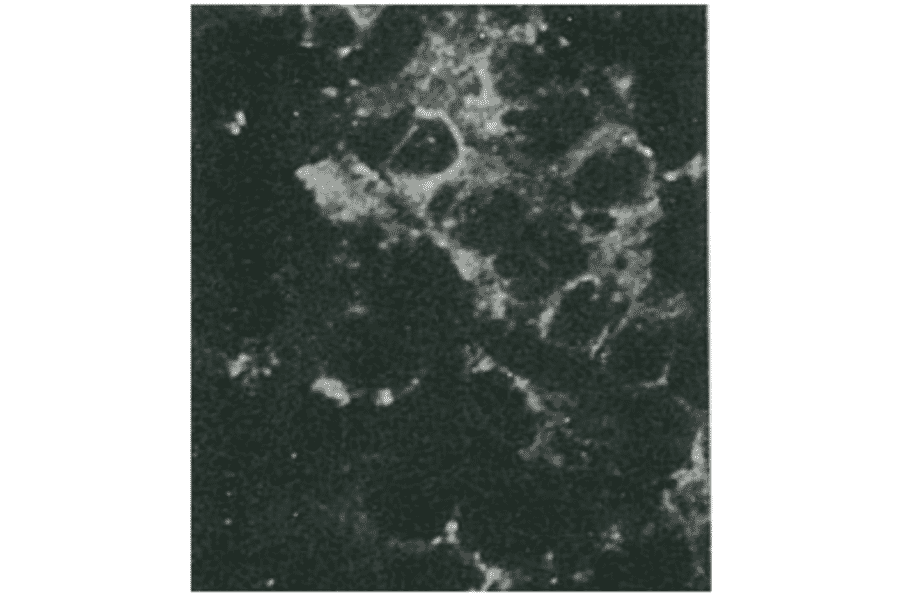 Detection of HCV NS4a protein by immunofluorescence antibody staining. Chimp liver cells were infected with recombinant vaccinia virus containing a HCV genome cDNA. After incubation for 48 hr, the cells were fixed with acetone and HCV NS4a protein was detected by indirect immunofluorescence staining using this antibody. 