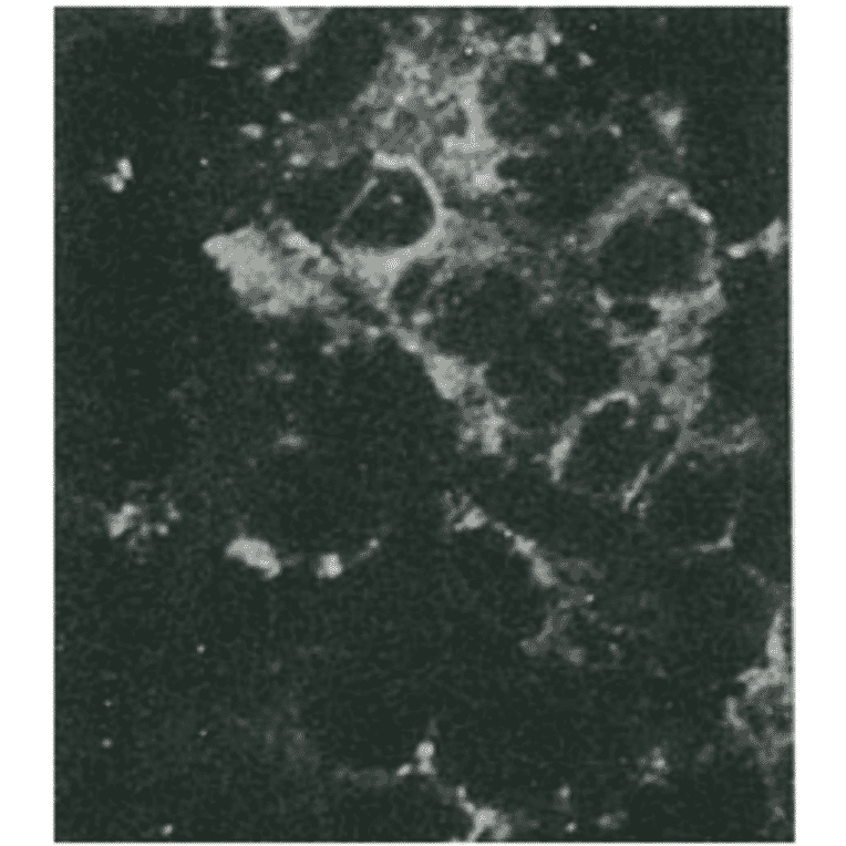 Detection of HCV NS4a protein by immunofluorescence antibody staining. Chimp liver cells were infected with recombinant vaccinia virus containing a HCV genome cDNA. After incubation for 48 hr, the cells were fixed with acetone and HCV NS4a protein was detected by indirect immunofluorescence staining using this antibody. 
