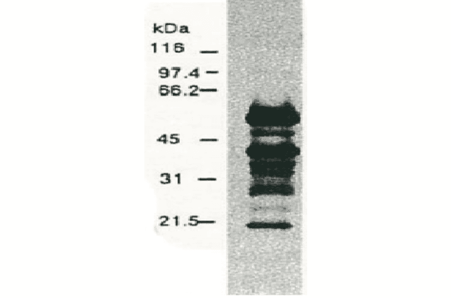 Western blotting of HCV NS5a protein.Chimp liver cells were infected with recombinant vaccinia virus containing a HCV genome cDNA and were subjected to Western blotting using the anti-NS5a antibody. The multitude of NS5a-specific products must be the degraded products of NS5a protein (52 kD). 