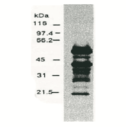 Western blotting of HCV NS5a protein.Chimp liver cells were infected with recombinant vaccinia virus containing a HCV genome cDNA and were subjected to Western blotting using the anti-NS5a antibody. The multitude of NS5a-specific products must be the degraded products of NS5a protein (52 kD). 