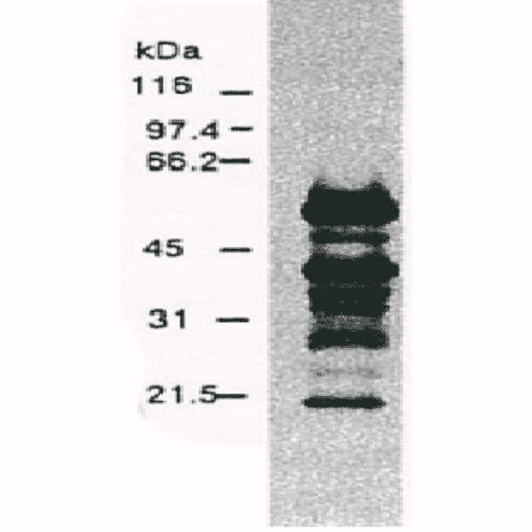 Western blotting of HCV NS5a protein.Chimp liver cells were infected with recombinant vaccinia virus containing a HCV genome cDNA and were subjected to Western blotting using the anti-NS5a antibody. The multitude of NS5a-specific products must be the degraded products of NS5a protein (52 kD). 