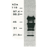 Western blotting of HCV NS5a protein.Chimp liver cells were infected with recombinant vaccinia virus containing a HCV genome cDNA and were subjected to Western blotting using the anti-NS5a antibody. The multitude of NS5a-specific products must be the degraded products of NS5a protein (52 kD). 