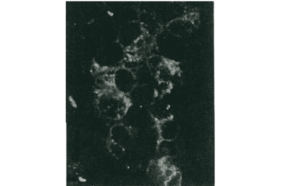 Detection of HCV NS5a protein by immunofluorescence antibody staining.Chimp liver cells were infected with recombinant vaccinia virus containing a HCV genome cDNA. After incubation for 48 hr, the cells were fixed with acetone and HCV NS5a protein was detected by indirect immunofluorescence staining using this antibody. 