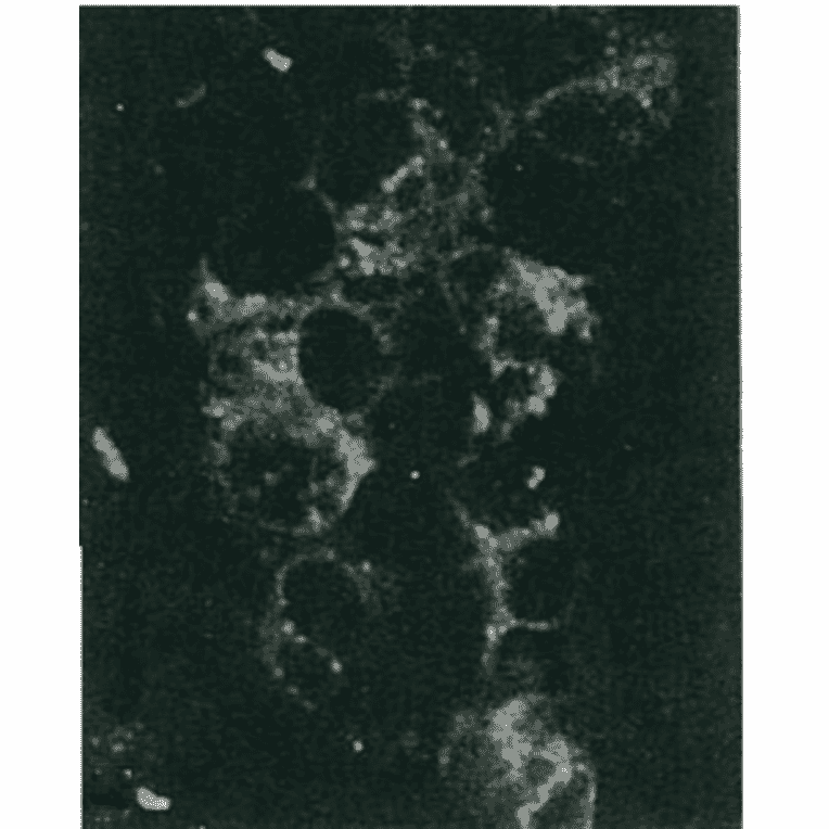 Detection of HCV NS5a protein by immunofluorescence antibody staining.Chimp liver cells were infected with recombinant vaccinia virus containing a HCV genome cDNA. After incubation for 48 hr, the cells were fixed with acetone and HCV NS5a protein was detected by indirect immunofluorescence staining using this antibody. 