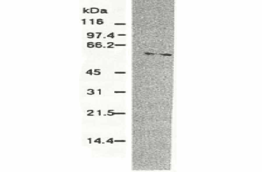 Western blotting of HCV NS5b protein. Chimp liver cells were infected with recombinant vaccinia virus containing a HCV genome cDNA and were subjected to Western blotting using this antibody. The NS5b protein is detected as a 58-kDa band. 