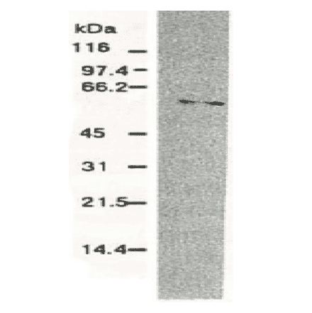 Western blotting of HCV NS5b protein. Chimp liver cells were infected with recombinant vaccinia virus containing a HCV genome cDNA and were subjected to Western blotting using this antibody. The NS5b protein is detected as a 58-kDa band. 