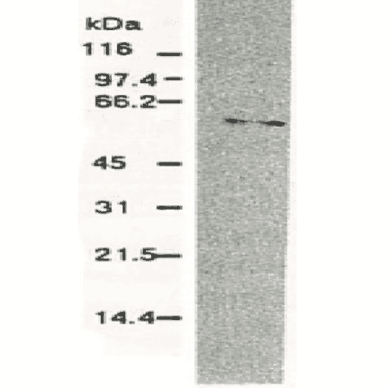 Western blotting of HCV NS5b protein. Chimp liver cells were infected with recombinant vaccinia virus containing a HCV genome cDNA and were subjected to Western blotting using this antibody. The NS5b protein is detected as a 58-kDa band. 