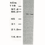 Western blotting of HCV NS5b protein. Chimp liver cells were infected with recombinant vaccinia virus containing a HCV genome cDNA and were subjected to Western blotting using this antibody. The NS5b protein is detected as a 58-kDa band. 