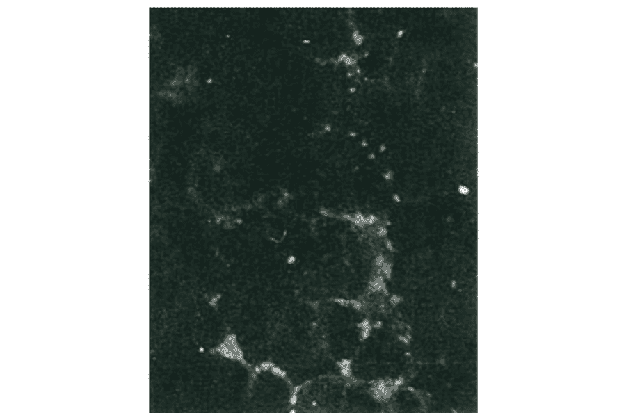 Detection of HCV NS5b protein by immunofluorescence antibody staining. 