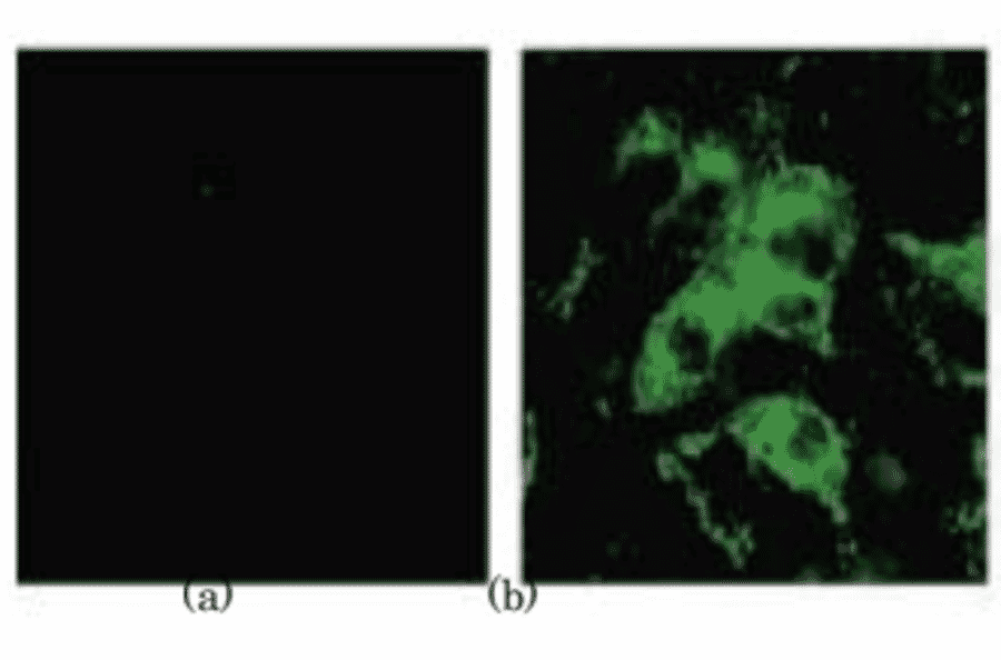 Identification of the spike antigen in the SARS virus infected cells by indirect immunostaining with 3A2 antibody. (a) Uninfected Vero E6 cells. (b) SARS virus infected Vero E6 cells.