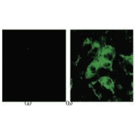 Identification of the spike antigen in the SARS virus infected cells by indirect immunostaining with 3A2 antibody. (a) Uninfected Vero E6 cells. (b) SARS virus infected Vero E6 cells.