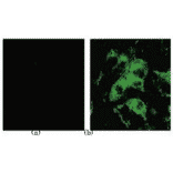 Identification of the spike antigen in the SARS virus infected cells by indirect immunostaining with 3A2 antibody. (a) Uninfected Vero E6 cells. (b) SARS virus infected Vero E6 cells.
