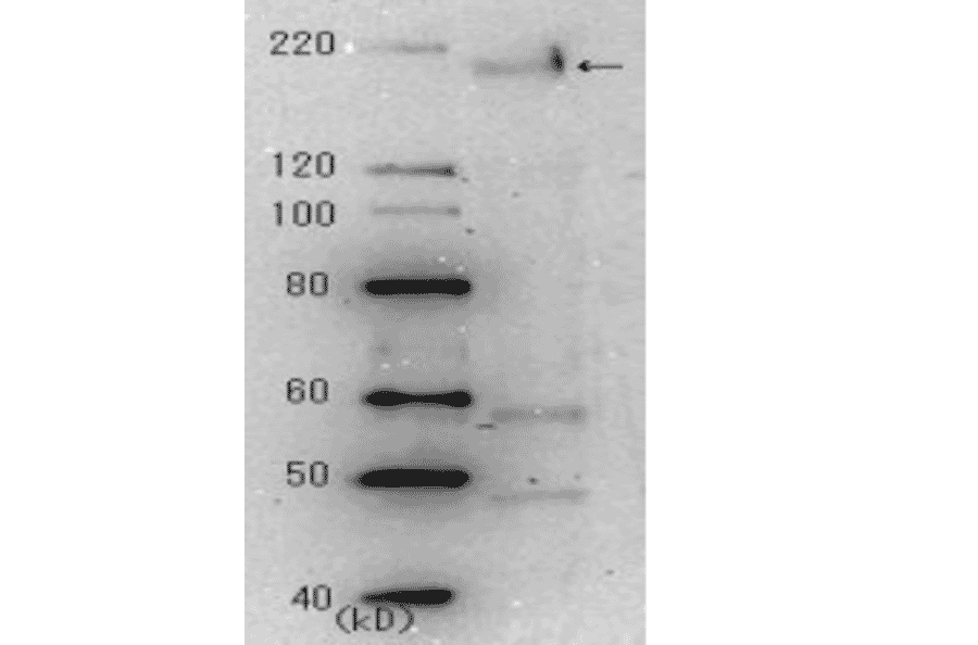 g 2. Identification of the spike glycoprotein in the crude extract of the SARS virus infected cells by Western blotting using 3A2 antibody at 10,000 fold dilution.