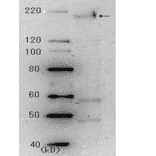 g 2. Identification of the spike glycoprotein in the crude extract of the SARS virus infected cells by Western blotting using 3A2 antibody at 10,000 fold dilution.