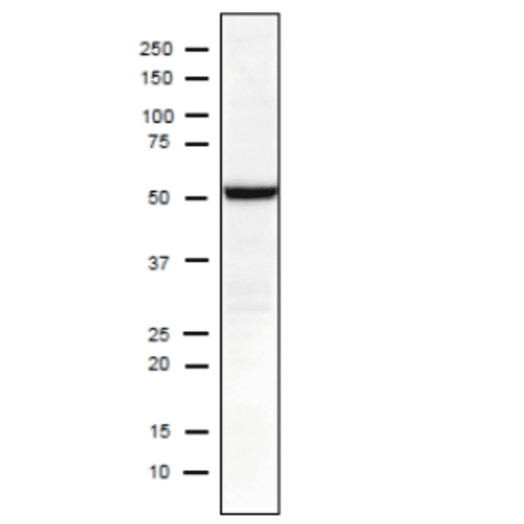 Identificationof Influenza Nucleoprotein in crude extract of MDCK cells infected with Influenza A virus (H1N1) PuertoRico/8/34 using C43 mnoclonal antibody. 10-20% gradient gel Blotting 15v, 30min (semi-dry) blocking over night, 4? 1st antibody 1/1000 dilution 2nd antibody 1/10,000 dilution; rabbit polyclonal secodary antibody to mouse IgG- H & L (HRP) (ab97046; abcam). Positions of molecular size markers are shown in kDa on the left. NP size is 56 kDa according to Swiss-Prot.