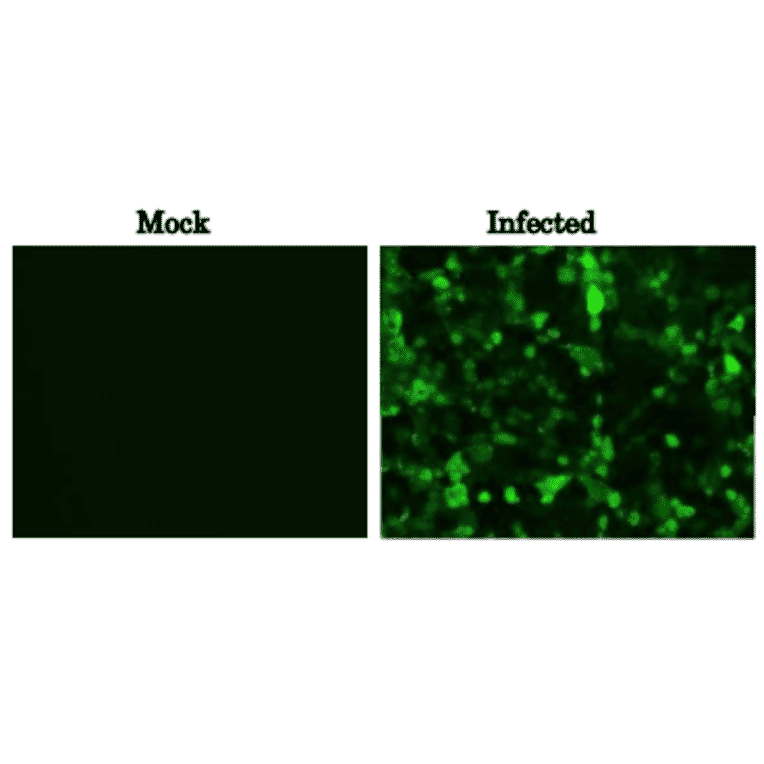 Immunofluorescence assay of MDCK (canine kidney ) cells infected with Influenza B virus, using anti-Influenza B virus M1 antibody (clone 6A11). Anti-Influenza B Virus M1 antibody (clone 6A11) efficiently detected the viruses in the infected MDCK cells with B/Florida/4/2006 virus. The cells were fixed with 4% paraformaldehyde in phosphate-buffered saline (PBS) and permeabilized with 0.1% Triton X-100 in PBS. The antibody (6A11) was used at 1/100 ditlution and the bound antibody was visualized by a further reaction with an Alexa Fluor 488-conjugated secondary antibody (green). Image on the left is a negative control, mock-infected MDCK cells.