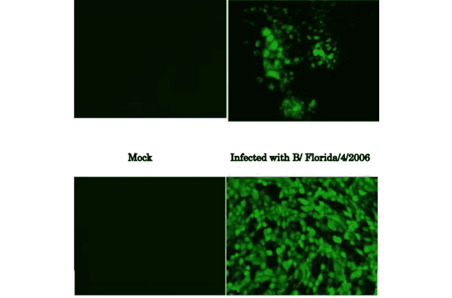 Immunofluorescence assay of MDCK (canine kidney ) cells infected with Influenza B virus, using anti-Influenza B virus NP antibody (clone 8C8). Samples were taken at 24 hours post-infection. Anti-Influenza B Virus NP antibody (clone 8C8) efficiently detected the viruses in the infected MDCK cells. The cells were fixed with 4% paraformaldehyde in phosphate-buffered saline (PBS) and permeabilized with 0.1% Triton X-100 in PBS. The bound antibody was visualized by a further reaction with an Alexa Fluor 488-conjugated secondary antibody. Images on the left are mock-infected MDCK cells as negative control. The cells infected with an Influenza B virus vaccine strain, Malaysia/2506/2004 as a representative of Victoria group is shown in the upper panel and Florida/4/2006 as Yamagata group in the lower panel.