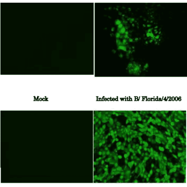 Immunofluorescence assay of MDCK (canine kidney ) cells infected with Influenza B virus, using anti-Influenza B virus NP antibody (clone 8C8). Samples were taken at 24 hours post-infection. Anti-Influenza B Virus NP antibody (clone 8C8) efficiently detected the viruses in the infected MDCK cells. The cells were fixed with 4% paraformaldehyde in phosphate-buffered saline (PBS) and permeabilized with 0.1% Triton X-100 in PBS. The bound antibody was visualized by a further reaction with an Alexa Fluor 488-conjugated secondary antibody. Images on the left are mock-infected MDCK cells as negative control. The cells infected with an Influenza B virus vaccine strain, Malaysia/2506/2004 as a representative of Victoria group is shown in the upper panel and Florida/4/2006 as Yamagata group in the lower panel.