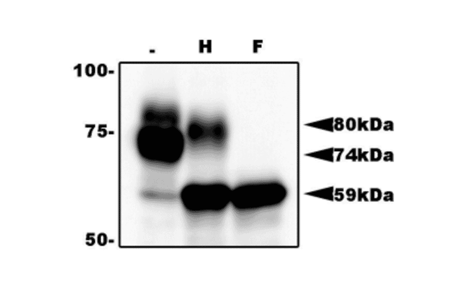 Identification of gQ1 in HHV-6A infected cells by western blotting using anti-gQ antibody (119). T-cell line HSB-2 cells were infected with HHV-6A at m.o.i of 0.1 and the cells were harvested at 72 h postinfection for lysate preparation for WB. gQ1 is detected as two glycoproteins with 80 kDa and 74 kDa molecular masses.. Sample lysates: (-) Non-treated. (H) Treated with end-glycosilase H. (F) Treated with peptide N-glycosidase F.