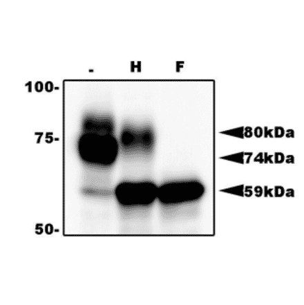 Identification of gQ1 in HHV-6A infected cells by western blotting using anti-gQ antibody (119). T-cell line HSB-2 cells were infected with HHV-6A at m.o.i of 0.1 and the cells were harvested at 72 h postinfection for lysate preparation for WB. gQ1 is detected as two glycoproteins with 80 kDa and 74 kDa molecular masses.. Sample lysates: (-) Non-treated. (H) Treated with end-glycosilase H. (F) Treated with peptide N-glycosidase F.