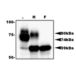 Identification of gQ1 in HHV-6A infected cells by western blotting using anti-gQ antibody (119). T-cell line HSB-2 cells were infected with HHV-6A at m.o.i of 0.1 and the cells were harvested at 72 h postinfection for lysate preparation for WB. gQ1 is detected as two glycoproteins with 80 kDa and 74 kDa molecular masses.. Sample lysates: (-) Non-treated. (H) Treated with end-glycosilase H. (F) Treated with peptide N-glycosidase F.