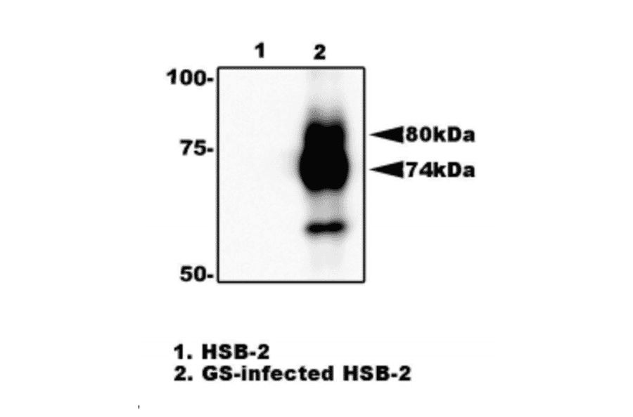 Fig.2. Immunoprecipitation of gQ1 from HHV-6A infected cell lysate with anti-gQ1 antibody (119). gQ1 protein was precipitated from the lysate of infected HSB-2 cells by using agarose beads-conjugated anti-gQ1 antibody (119), and processed for western blotting by using anti-gQ1 antibody (119). Lane 1; HSB-2 cells. Lane 2; HSB-2 cells infected with HHV-6A GS strain