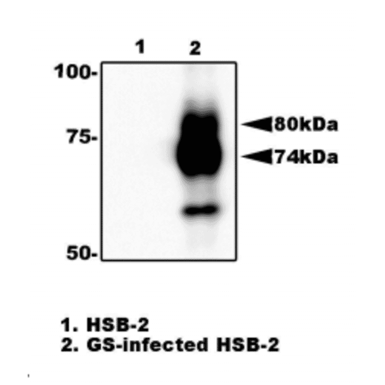 Fig.2. Immunoprecipitation of gQ1 from HHV-6A infected cell lysate with anti-gQ1 antibody (119). gQ1 protein was precipitated from the lysate of infected HSB-2 cells by using agarose beads-conjugated anti-gQ1 antibody (119), and processed for western blotting by using anti-gQ1 antibody (119). Lane 1; HSB-2 cells. Lane 2; HSB-2 cells infected with HHV-6A GS strain