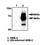 Fig.2. Immunoprecipitation of gQ1 from HHV-6A infected cell lysate with anti-gQ1 antibody (119). gQ1 protein was precipitated from the lysate of infected HSB-2 cells by using agarose beads-conjugated anti-gQ1 antibody (119), and processed for western blotting by using anti-gQ1 antibody (119). Lane 1; HSB-2 cells. Lane 2; HSB-2 cells infected with HHV-6A GS strain