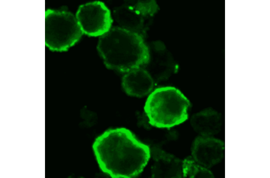 Immuno-staining of gQ1 in HHV6A infected HSB-2 cells by using anti-gQ1 antibody. The infected cells were harvested 3 days postinfection, fixed in cold acetone and immunostained with FITC-conjugated anti-gQ1 antibody (119). Specific immunofluorescence was observed with a confocal laser scanning