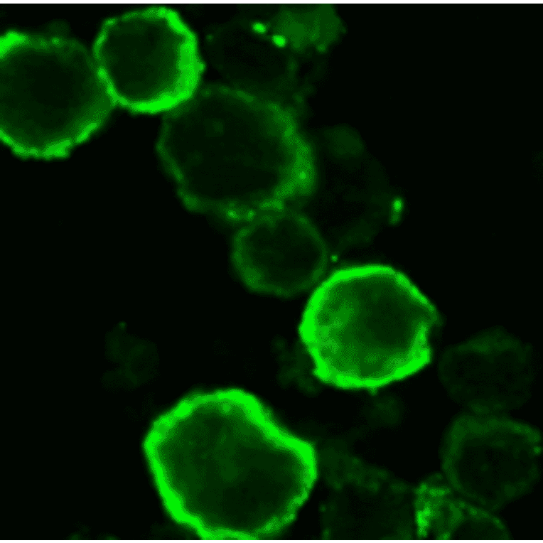 Immuno-staining of gQ1 in HHV6A infected HSB-2 cells by using anti-gQ1 antibody. The infected cells were harvested 3 days postinfection, fixed in cold acetone and immunostained with FITC-conjugated anti-gQ1 antibody (119). Specific immunofluorescence was observed with a confocal laser scanning