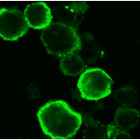 Immuno-staining of gQ1 in HHV6A infected HSB-2 cells by using anti-gQ1 antibody. The infected cells were harvested 3 days postinfection, fixed in cold acetone and immunostained with FITC-conjugated anti-gQ1 antibody (119). Specific immunofluorescence was observed with a confocal laser scanning