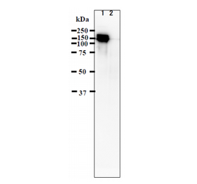 Identification of IE62 protein in VZV-infected cells by western blotting using anti-VZV IE62 antibody (clone 62A).