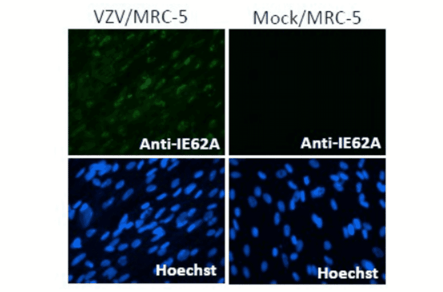 Immunofluorescence staining of VZV IE62 protein in VZV-infected MRC-5 cells by using anti-VZV IE62 antibody (clone 62A).