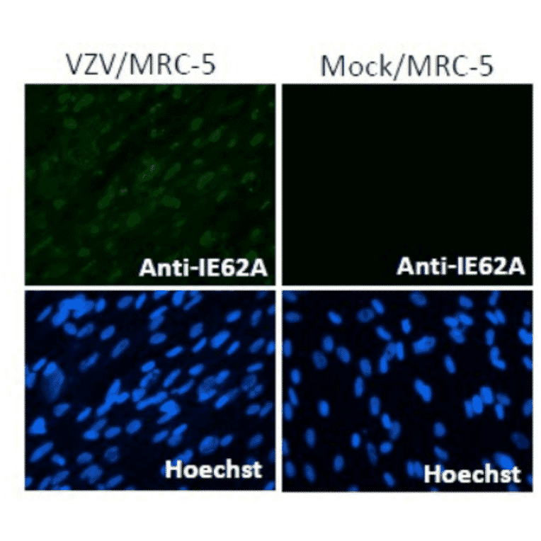 Immunofluorescence staining of VZV IE62 protein in VZV-infected MRC-5 cells by using anti-VZV IE62 antibody (clone 62A).