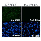 Immunofluorescence staining of VZV IE62 protein in VZV-infected MRC-5 cells by using anti-VZV IE62 antibody (clone 62A).
