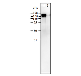 Identification of IE62 protein in VZV-infected cells by western blotting using anti-VZV IE62 antibody (clone 62B).