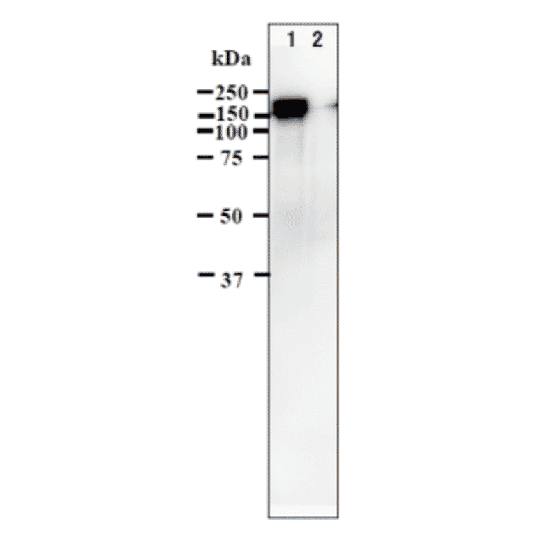 Identification of IE62 protein in VZV-infected cells by western blotting using anti-VZV IE62 antibody (clone 62B).