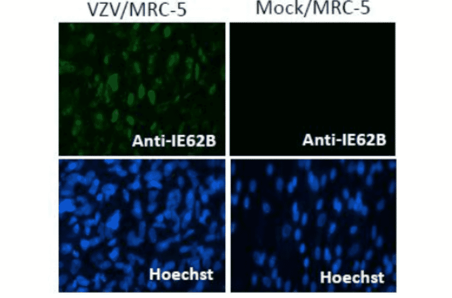 Immunofluorescence staining of VZV IE62 protein in VZV-infected MRC-5 cells by using anti-VZV IE62 antibody (clone 62B).